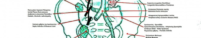 DIsc Disk Pain Herniated Bulging Chiropractor Frederick